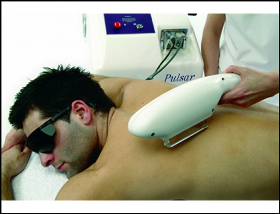 Advanced Pulsed Light Systems - Laser Hair Removal for Men